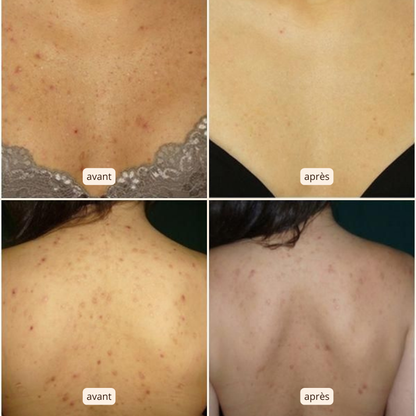 Éponge Filet Africaine – Exfolie, nettoie et adoucit – pour une peau saine et lisse